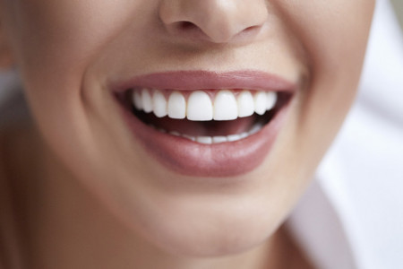 Kako do holivudskog osmeha: Top 3 saveta za lepe i zdrave zube