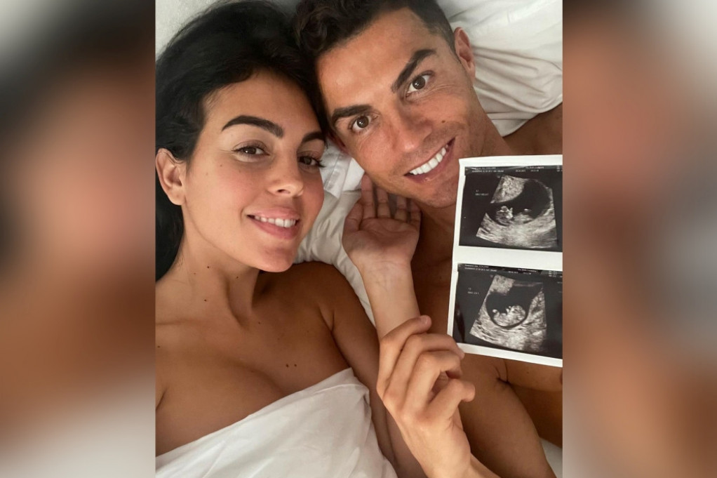 Trudna Heorhina podelila fotografiju sa ultrazvuka, Ronaldova reakcija oduševila fanove (foto)