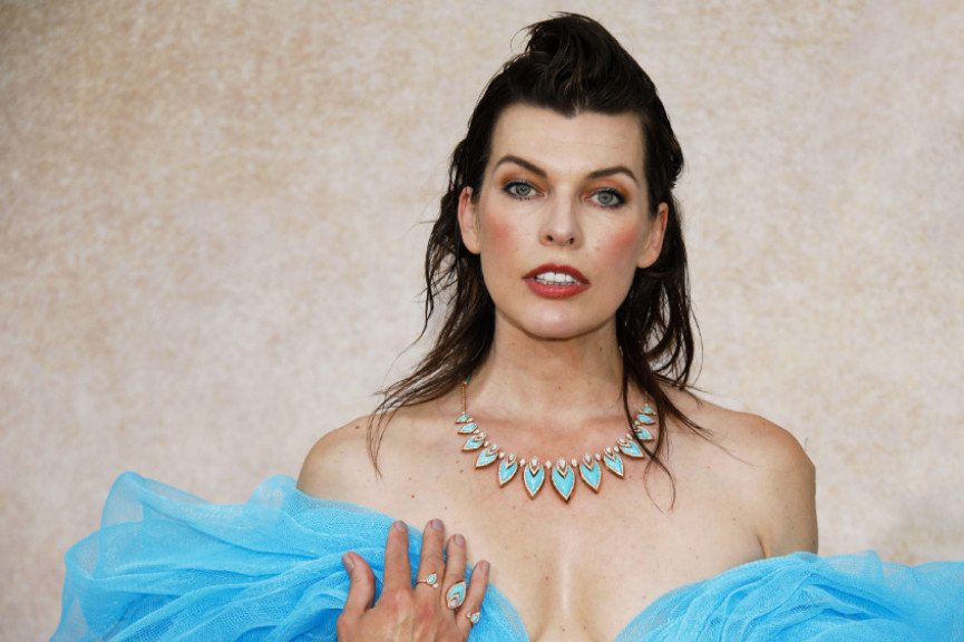 Šta se desilo jednoj od najlepših žena sveta? Mila Jovović šokirala izgledom, nasred glave obrijana rupa FOTO