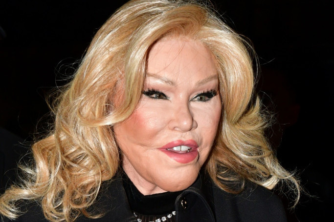 Iz straha da je muž ne ostavi UNAKAZILA JE LICE operacijama: Izgledom danas plaši ljude, a nekada je bila boginja lepote FOTO