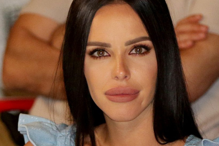 Bogdana Ražnatović izvadila silikone iz usana, ovako sada izgleda